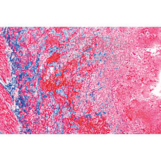 LIEDER Pathologische Histologie des Menschen Basisserie 50 Präparate