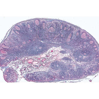Lymphdrüse vom Schwein, quer