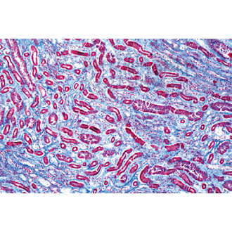 LIEDER Pathologische Histologie des Menschen Grundserie Teil II.  40 Präparate