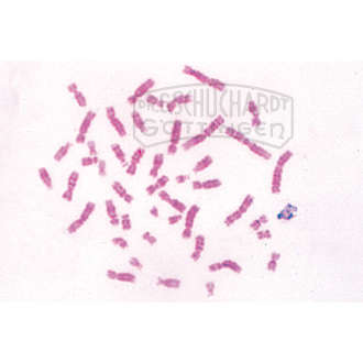 Chromosomen des Menschen