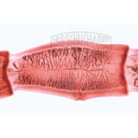Taenia spec., Bandwurm Präparat