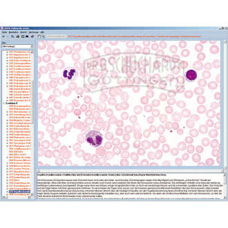 LIEDER CD-ROM Mikroaufnahmen Zeichnungen & Begleitmaterial zur Schulserie A