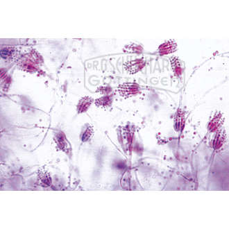 Penicillium, Pinselschimmel, Myzel und Konidiophoren total