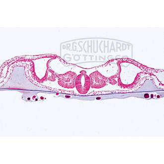 Embryo vom Huhn, 48 Stunden alt, quer