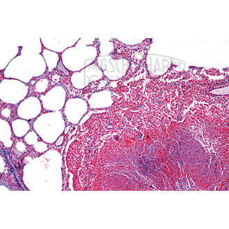 LIEDER Pathologische Histologie des Menschen Grundserie Teil I. 40 Präparate