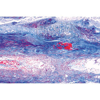 LIEDER Pathologische Histologie des Menschen Ergänzungsserie 41 Präparate